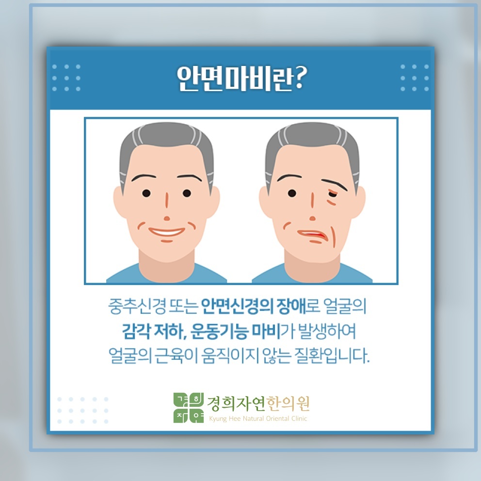초기 대응이 중요한 안면신경마비의 회복 과정