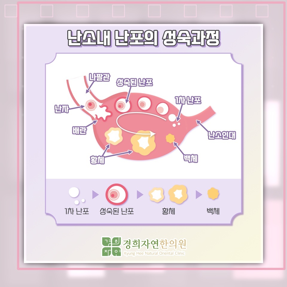 다낭성난소증후군과 부정출혈의 양상 및 관리 방향